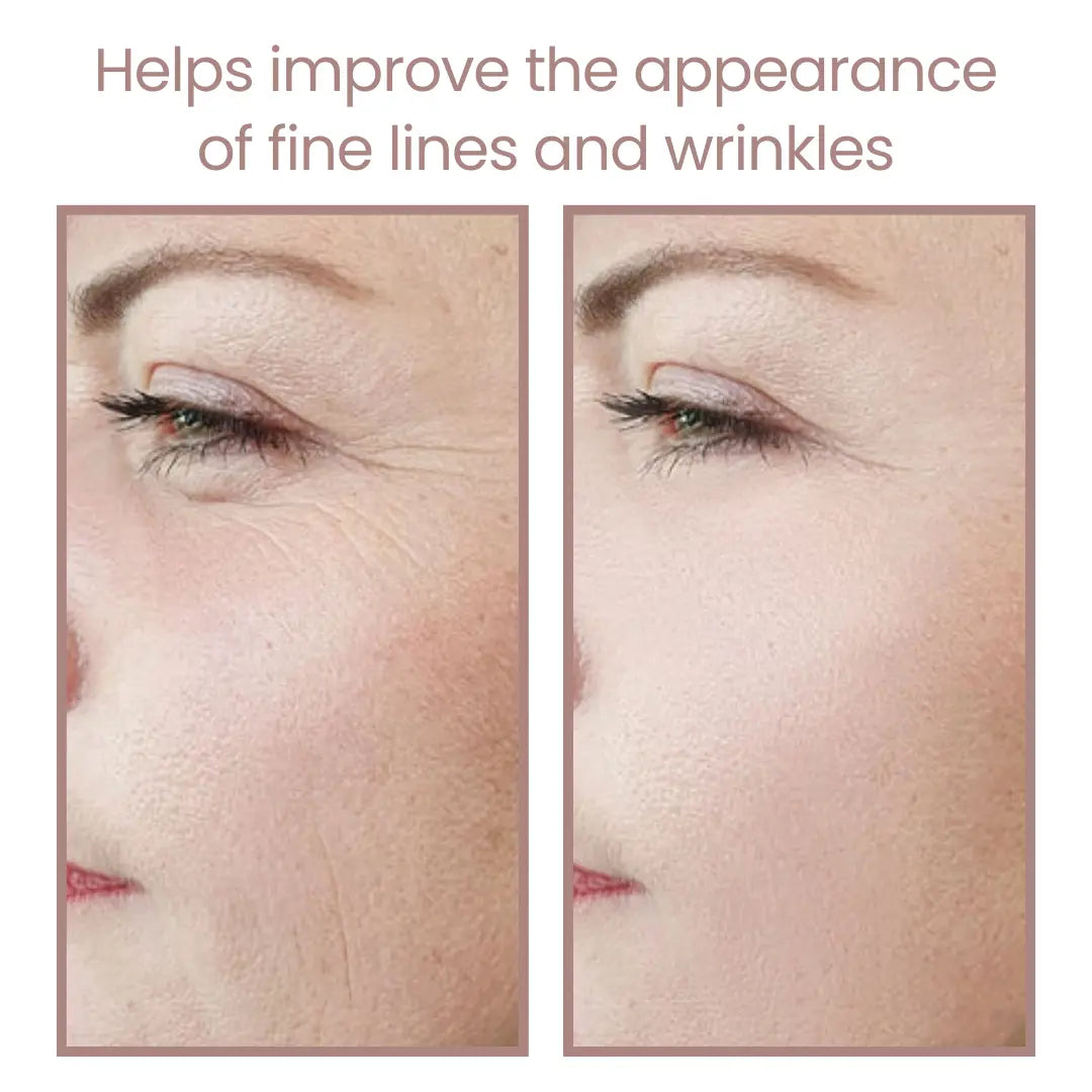 Dispositivo de Rejuvenecimiento Facial